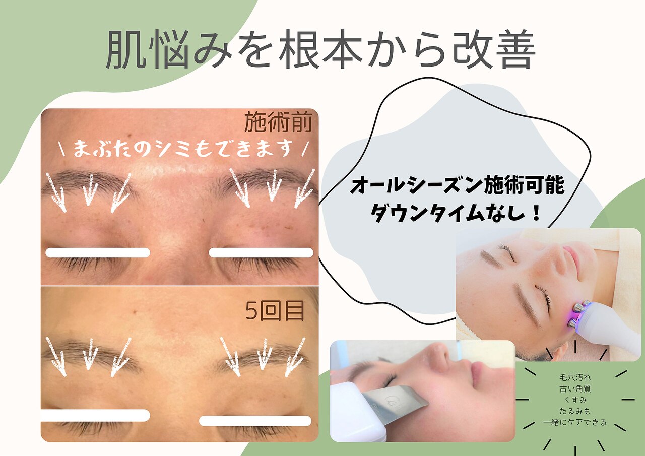 リーフ｜ホットペッパービューティー