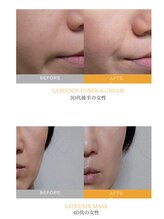 ワイズデュー(Y's Dew)/volayon黄：ラティニックス 美白