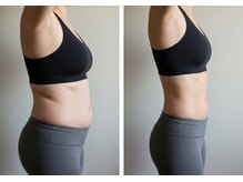 メディ(Mediiy)/ハイパーナイフ