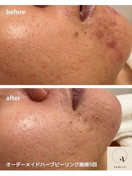 ココ 2号店(CoCo)/