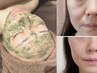 【ほうれい線・たるみ】気になり始めたら｜ハーブピーリング+肌診断¥17,800→