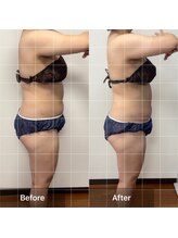 インナーメス(INNER MES)/全身当てるだけで変わる！