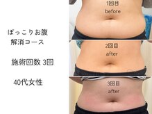 ほねつぎ一休さん 宇品店の雰囲気（最新機器で美肌・ダイエットから体の不調まで解消！）