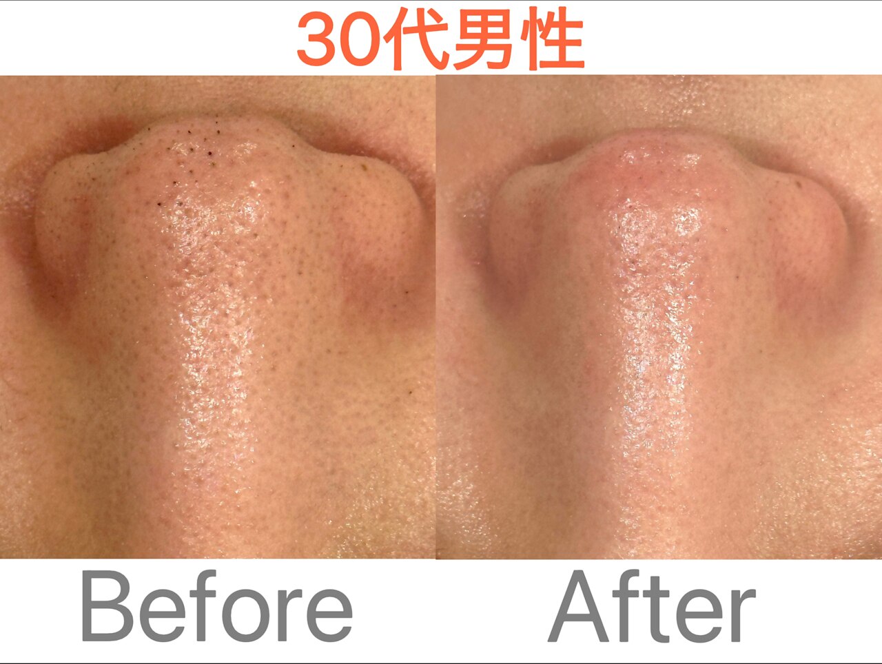 洗顔サロン 池袋(SENGAN)｜ホットペッパービューティー