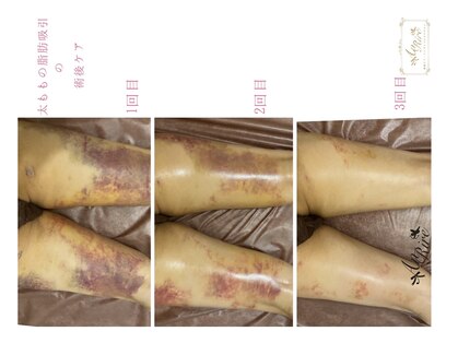 インディバサロン アンリール(An Rire)の写真