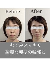 ハリサロンドオフ 心斎橋店(hari salon de off)/むくみスッキリ
