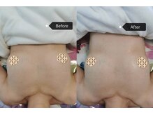 シークレット(Secret)/ビフォーアフター写真です。