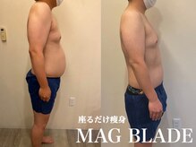 メディカルサロン フィオレ(fiore)/MAG BLADEお腹集中コース