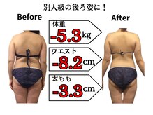セル脂肪をドバっと撃退！太ももに隙間を作ります◎骨盤矯正+最新スリム超音波でほっそり美脚＆美尻実現！