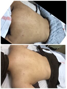 オアジスパ(Oasi Spa)/１回。黒くくすんだ色も明るく。