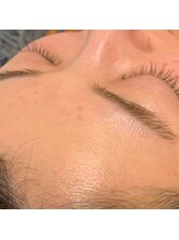 ミメル バイ ラフォンテ(mimelle by LAFONTE)/フェイシャルワックスエステ