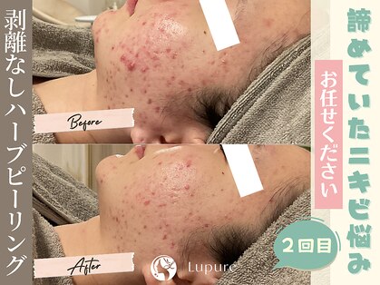 ルプレ(Lupure)の写真