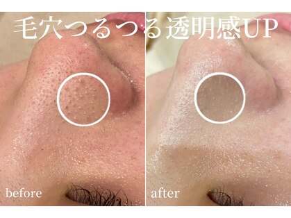 ハティア(hattia)の写真