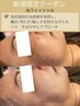 【シミ・くすみケア】透明感UP！光フェイシャル¥9980