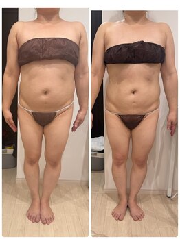 ありひ/セルゼロの効果！！