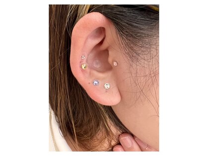 脱毛専門店エステックスの写真