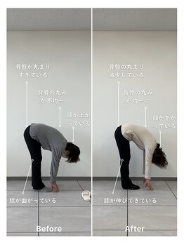 ハル 箕面(HALU)/4回目before&after姿勢改善