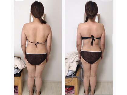 ビューティーチャージ(BeautyCharge)の写真