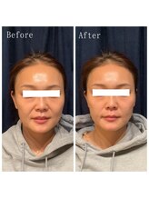 たくろう鍼灸院 豊田本院/Before＆After