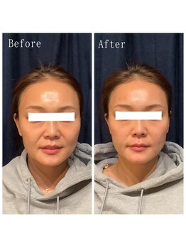 たくろう鍼灸院 豊田本院/Before&After