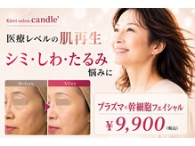 キャンドル(candle')