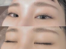 クレセント アイアンドネイル 今泉店(Crescent)/レーザーセーブル