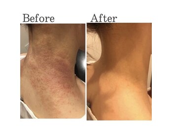 ハイケア グラン ギンザ(HYCARE GRAND GINZA)/日本ーの肌改善サロン実力/銀座