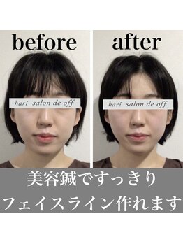 ハリサロンドオフ 心斎橋店(hari salon de off)/フェイスラインがスッキリ☆