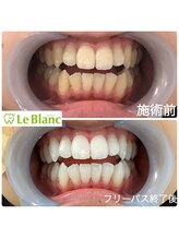 ルブラン 奈良店(Le Blanc)/学生の方も大歓迎！