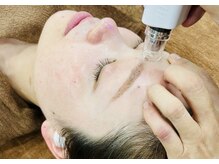 モカラ(MOKARA)/ダウンタイムなしの美容無針！！