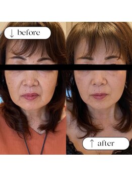 トータルビューティーサロンリア(Li'a)/ビフォー＆アフター