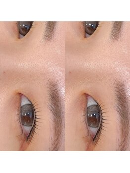 アイスタイル エポカ高根台店/【シンプリフィラッシュリフト】