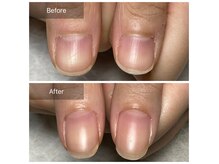 今よりもっと女性らしい美しい手元に★