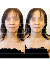 ディーバ 北浜(Diva)/毛穴洗浄付き！韓国小顔コルギ