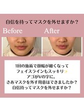 ピオニー(Peony)/Before & After