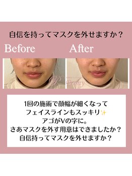 ピオニー(Peony)/Before & After
