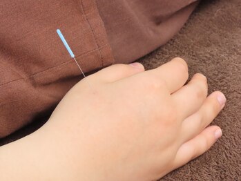 梅沢鍼灸院/自律神経には合谷