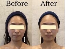 小顔フェイスラボ 桑名店(小顔FaceLabo.)/◆小顔コルギ Before→After◆