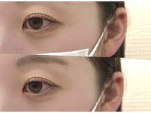 アルーマ アイ(allma.eye)/まつ毛パーマ &nbsp;ラッシュリフト