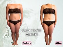 ポノ 茅ヶ崎(Pono.)/脂肪・破壊！セルライトゼロ２