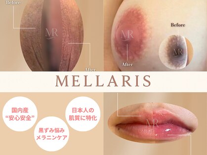 フェミニン(Feminine)の写真