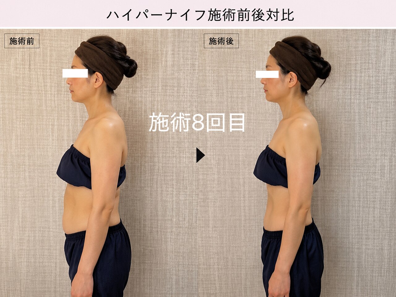 丸の内駅でダイエットが人気のエステサロン｜ホットペッパービューティー