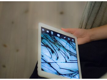 フロッグスター(FROG STAR)/マイクロスコープによる頭皮診断