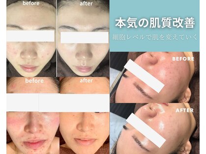 スキンベイビー 池袋店(Skin Baby)の写真