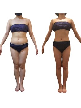 ナリジム 赤坂/4カ月-14kg(身長158cm47キロ