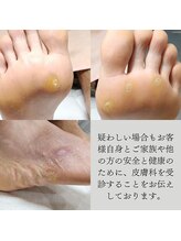 ドクターネイル爪革命 長野店/《施術不可能な場合の参考例》