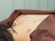 梅沢鍼灸院/寒い時期にはお灸