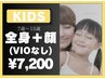 【キッズ脱毛】2回目以降　全身＋顔(VIOなし)60分¥7,200