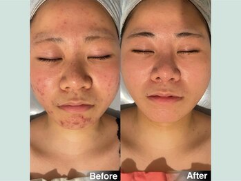 韓美 表参道店(HANMI)/