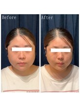 たくろう鍼灸院 豊田本院/Before＆After